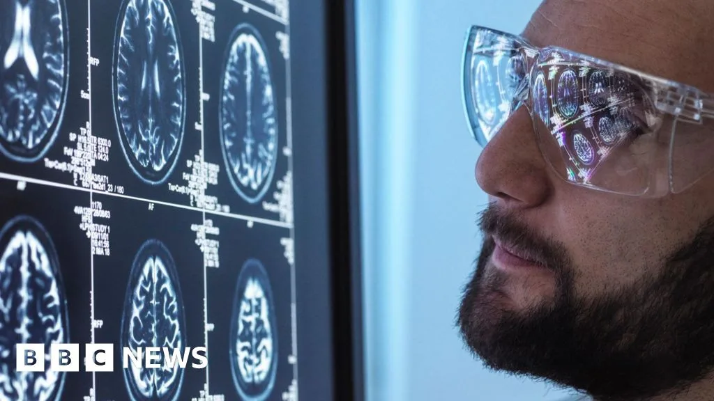 سيماغلوتيد يفشل في إبطاء تطور مرض الزهايمر