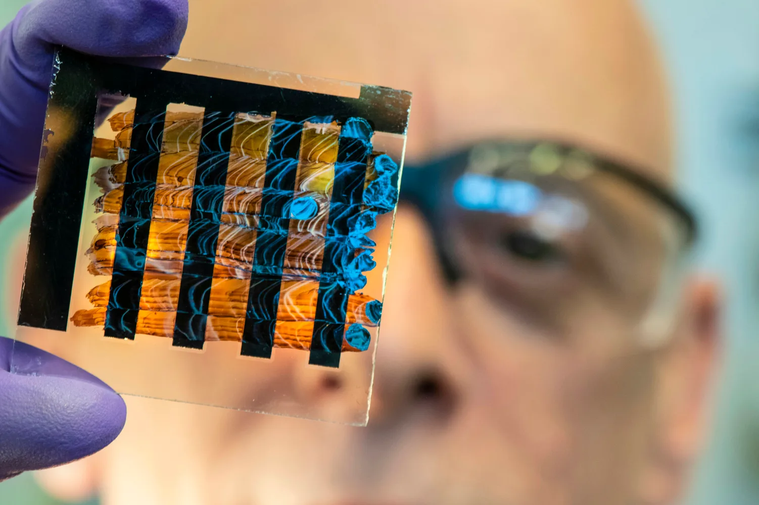 Ozempic, Wegovy & Mounjaro: AI Uncovers New Patient-Reported Side Effects