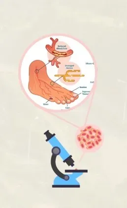 芥子酸：糖尿病傷口癒合的天然助力？