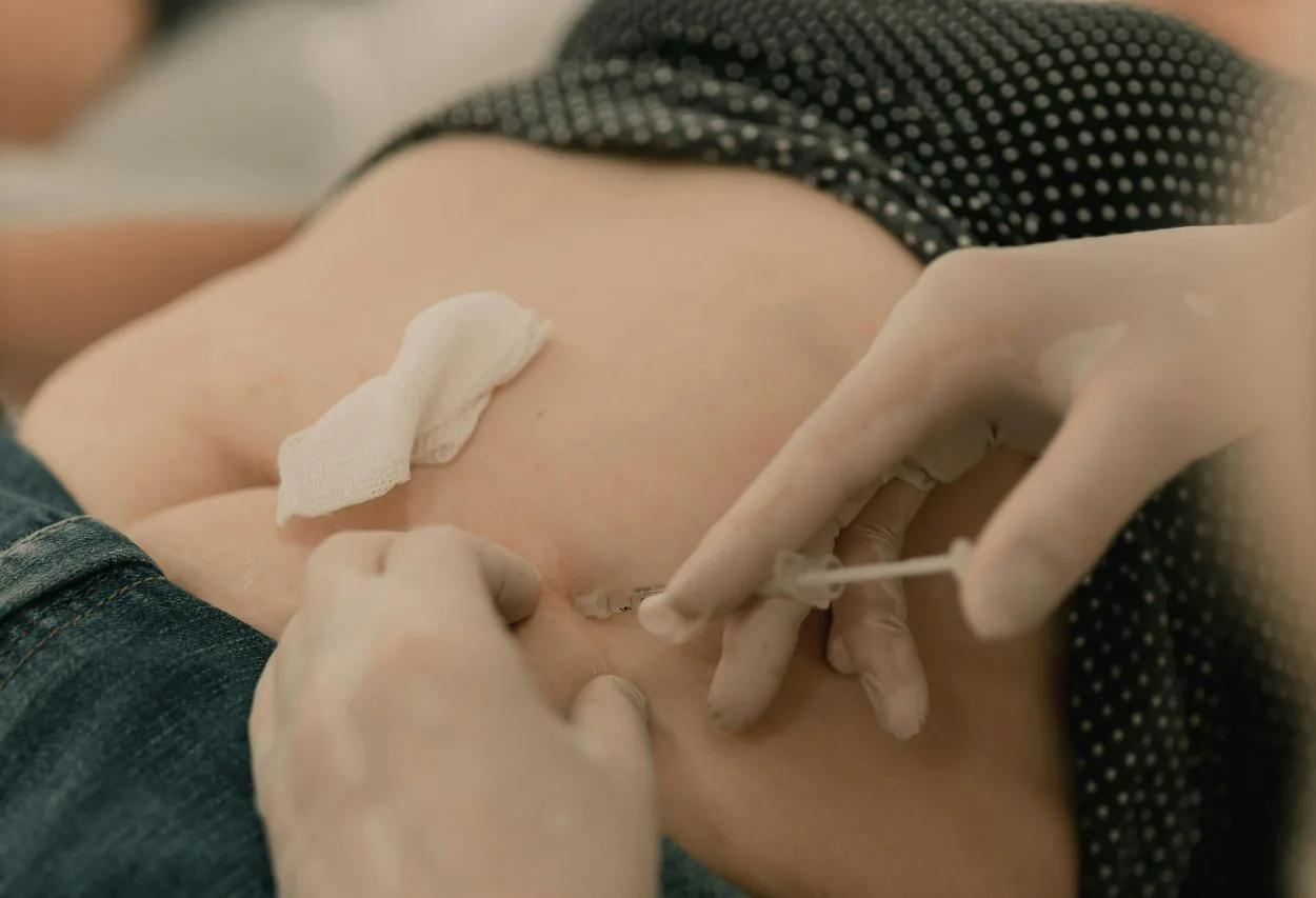 Wegovy Nebenwirkungen: Schwarze Zunge und Gallenblasenentfernung