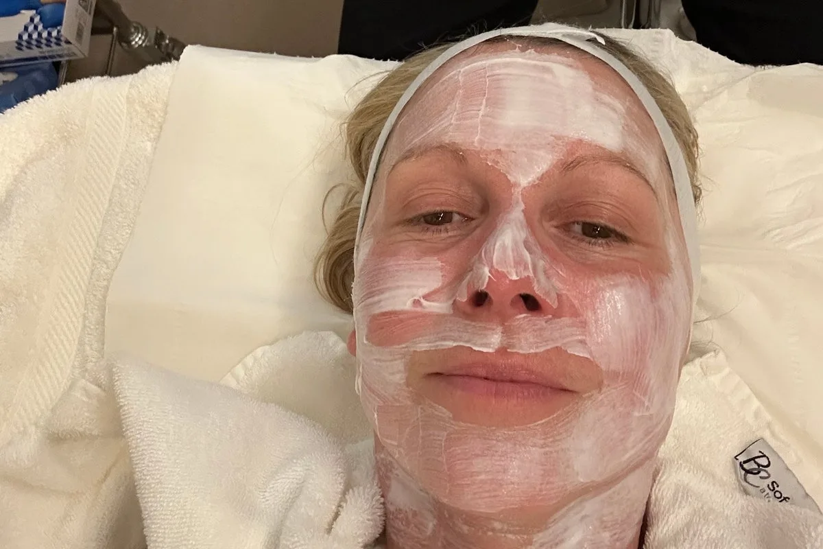 Peptides: Fad or Future? Unpacking the Hype for Skin, Weight Loss & More