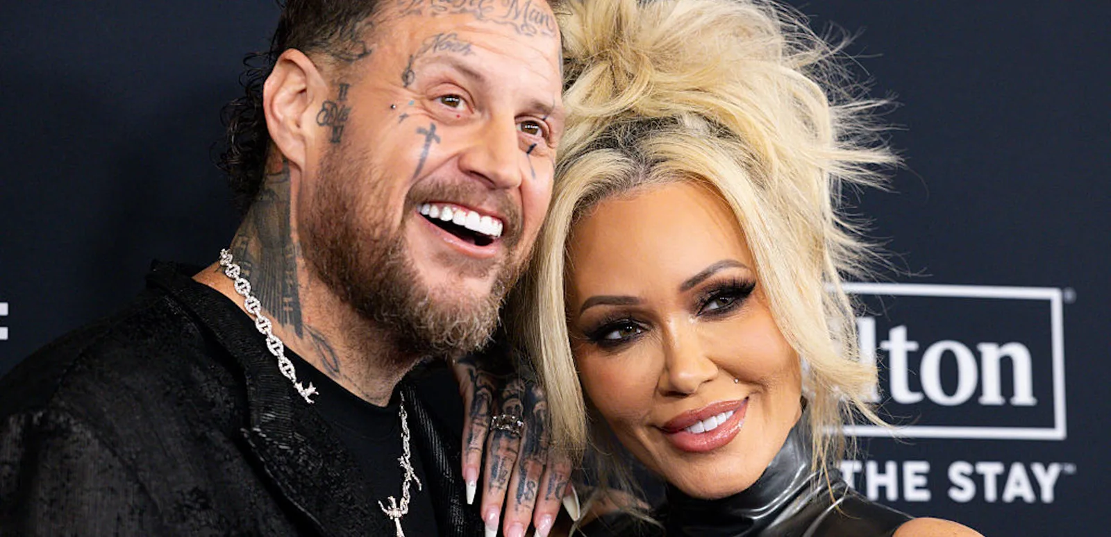 Bunnie Xo Ungkap Ide Bunuh Diri 'Mengerikan' dari Obat GLP-1