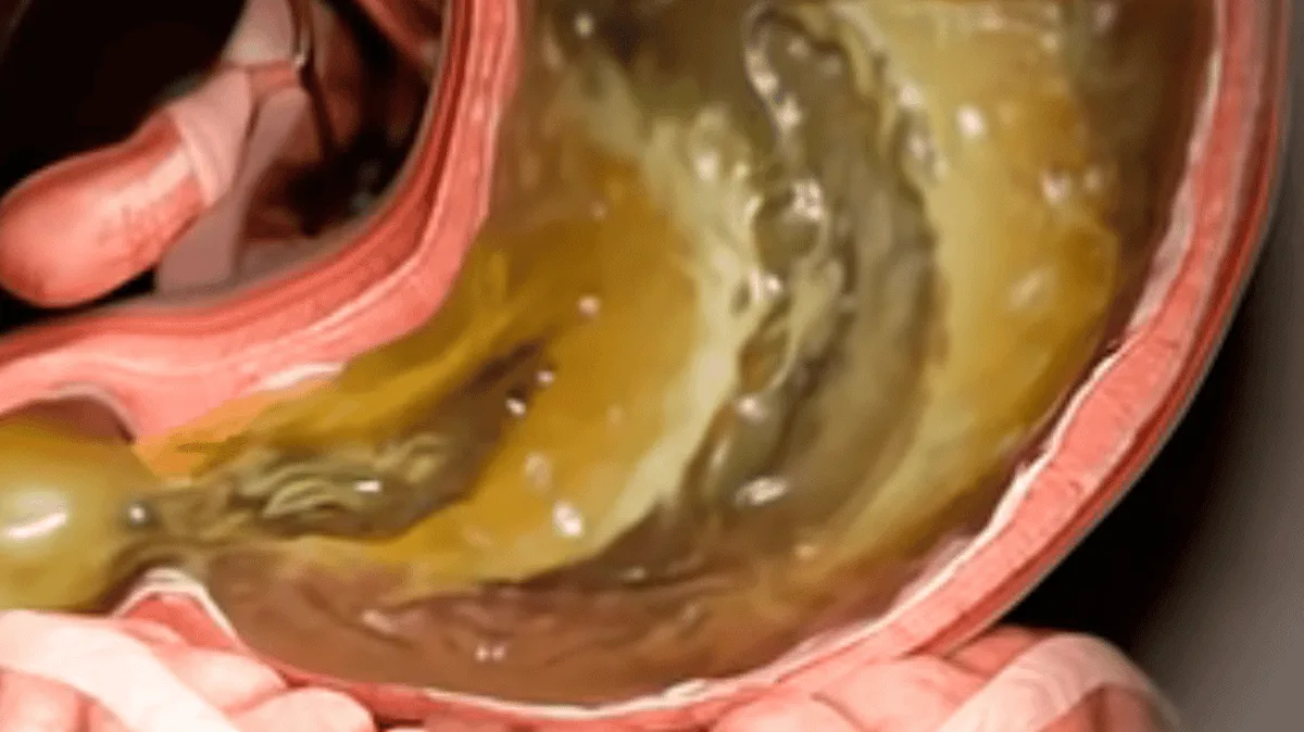 GLP-1 Medications: Understanding Ozempic, Wegovy, and Mounjaro