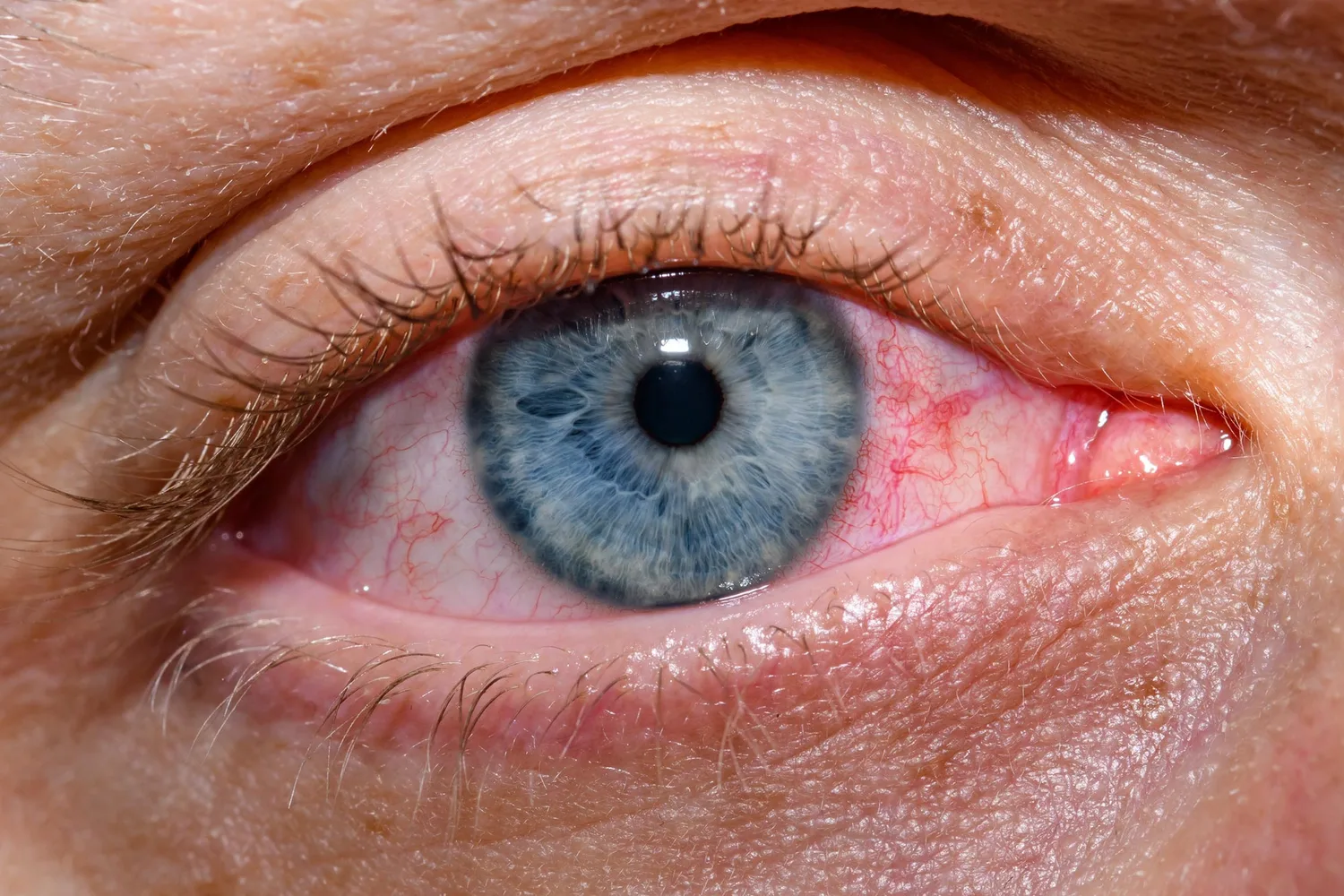 Wegovy Linked to Sudden Vision Loss Risk, Study Finds