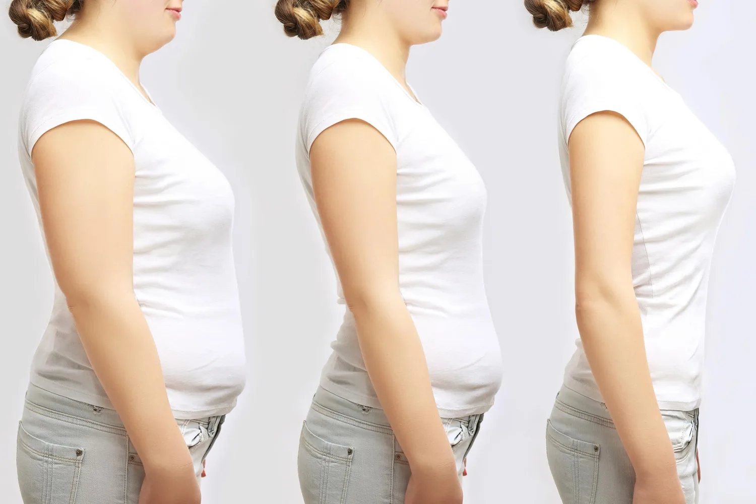 Orforglipron: The New Oral GLP-1 Challenger in Weight Loss