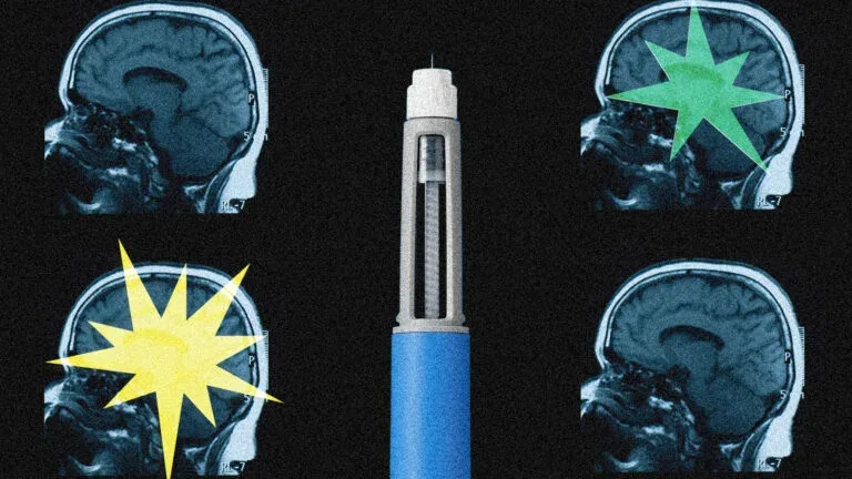 Beyond Appetite: How GLP-1 Drugs May Be Rewiring the Human Brain